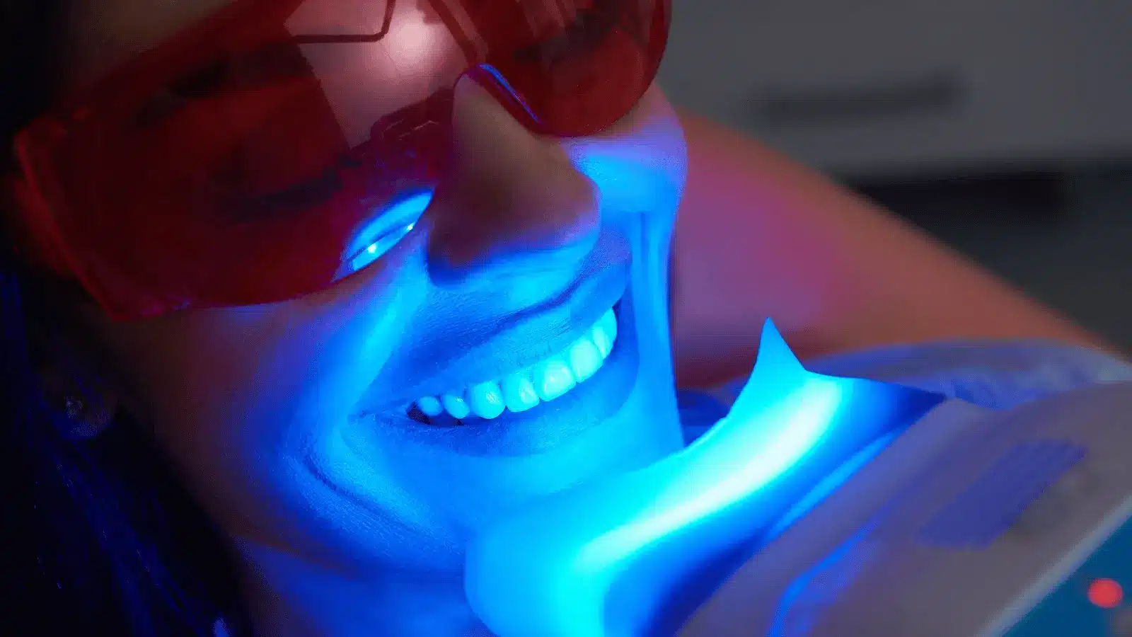 Featured image for “Why Professional Teeth Whitening Is Worth the Cost?”