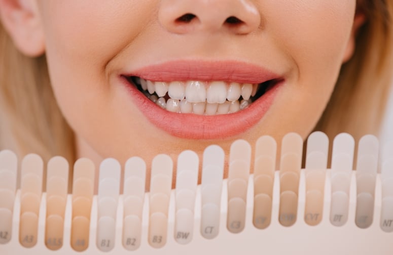 Featured image for “How Do You Rehydrate Teeth After Whitening in Union?”