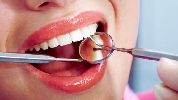 Featured image for “Amazing Benefits of Composite Bonding for Your Smile”